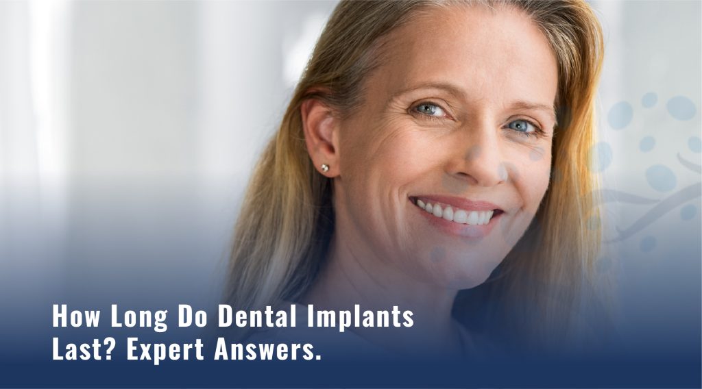 How Long Do Dental Implants Last - Expert Answers - Implant Center Thousand Oaks California - Implant Dentist Thousand Oaks CA - Best Dental Implants Thousand Oaks