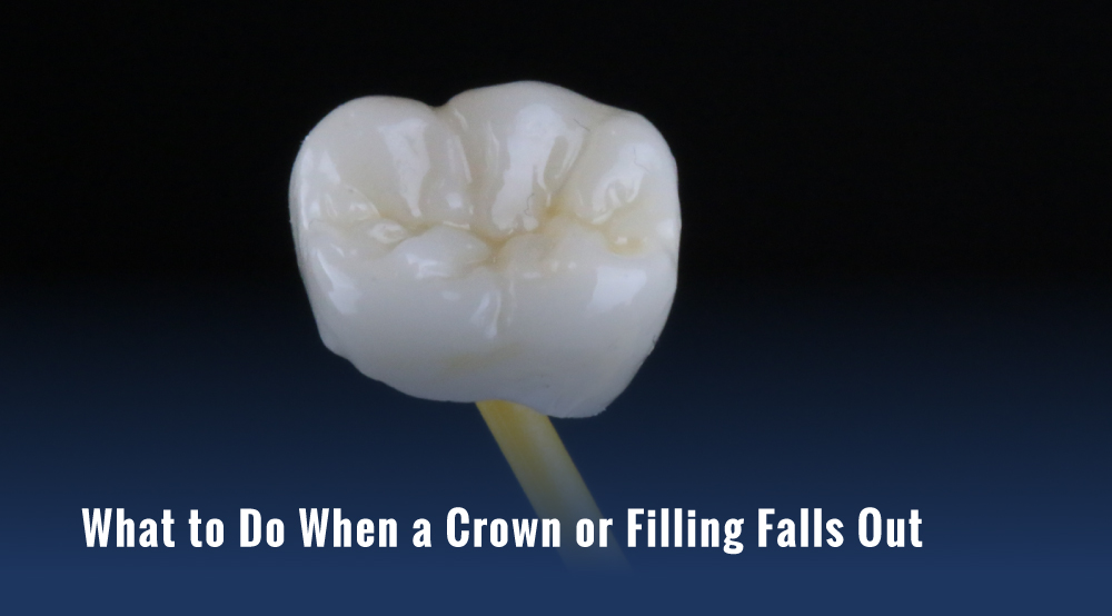 Single ceramic dental crown held up against a dark background